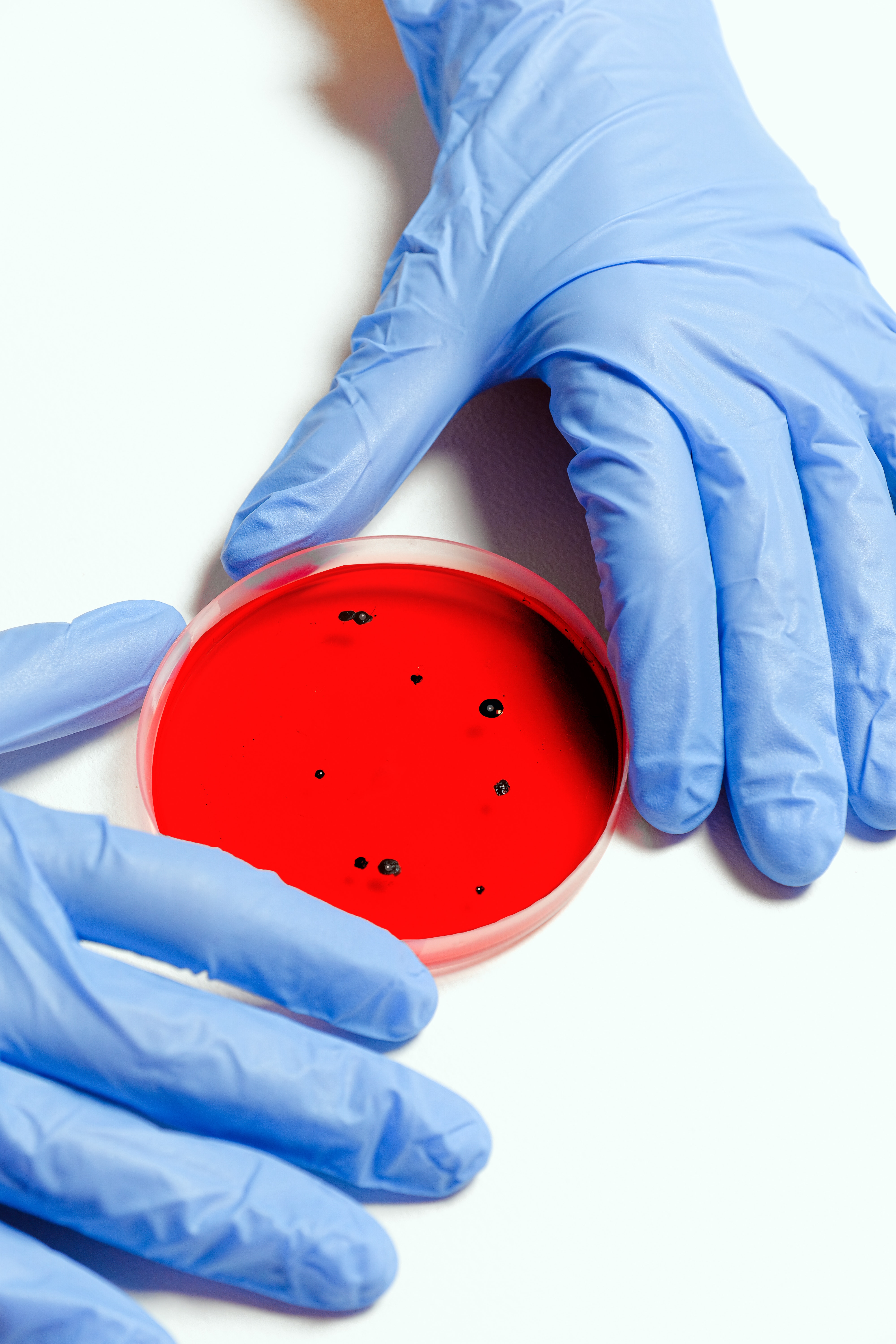 Microbe sans frontières à la découverte d'un émergent. Quel impact sur notre Microbe sans frontières à la découverte d'un émergent. Quel impact sur notre