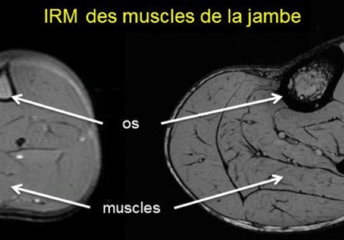 IRM des muscles de la jambe chez l'homme et chez le rat