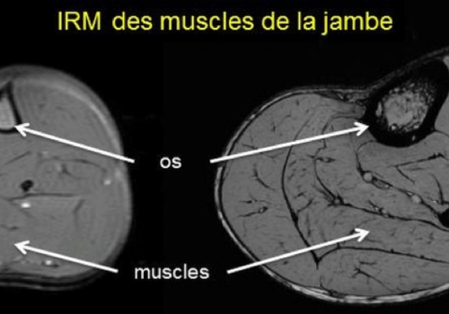 Comparaison des muscles de la jambe chez l'homme et chez le rat par IRM IRM des muscles de la jambe chez l'homme et chez le rat