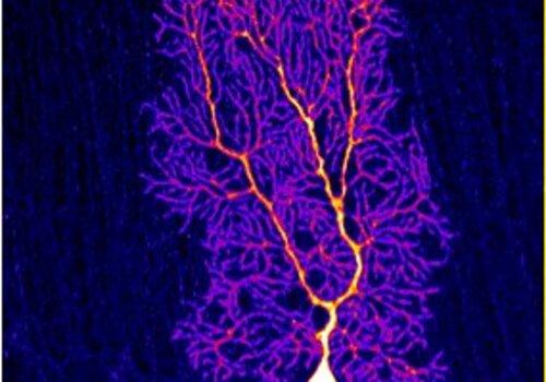 Neurone du cortex cérebelleux coloré
