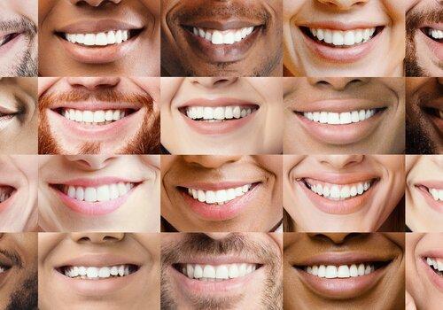 Patchwork de photos de bouches souriantes.
