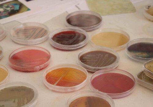 Cultures microbiennes sur géloses colorées en boîtes de pétri
