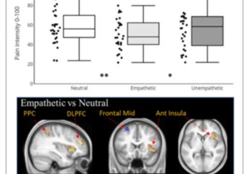 visuel neurosciences