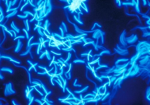 Spermatozoïdes de coq révélés par fluorescence supra-vitale (Hoechst 33342). Spermatozoïdes de coq révélés par fluorescence supra-vitale (Hoechst 33342).