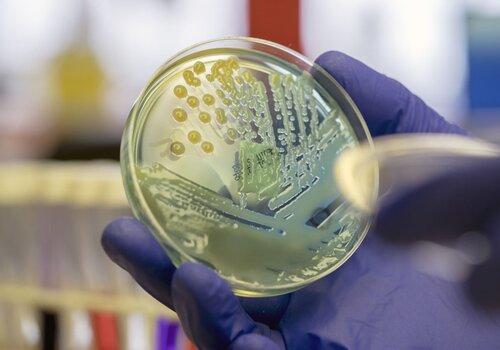 Colonies de bactéries sur milieu gélosé