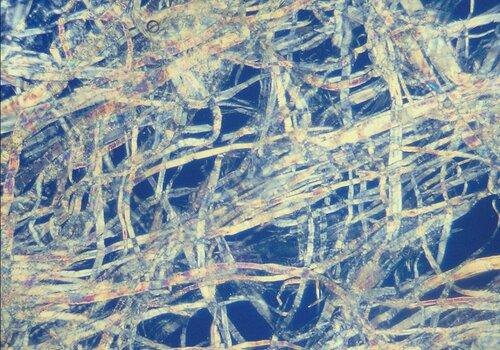 Pulp from a paper bag magnified 200 times with a polarizing filter. Cropped frame ca https://upload.wikimedia.org/wikipedia/commons/5/5d/Zellstoff_200_fach_Polfilter.jpg