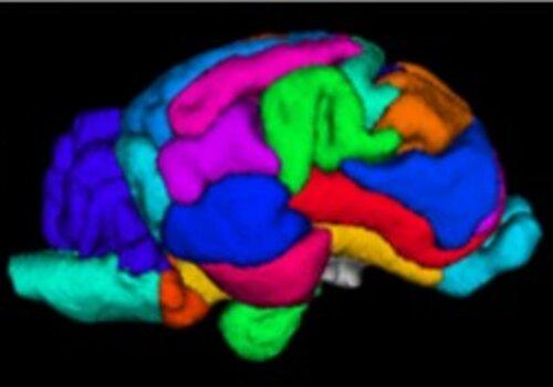 Cerveau arlequin L'imagerie par résonance magnétique (IRM) permet d'identifier les différentes aires du cerveau.