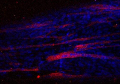 Image de microscopie optique de myotube différencier après immunomarquage