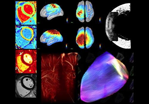 Coeur en mouvement, cerveau en action, os en transparence ... les nouvelles voies de la recherche Ultrasons, IRM, EEG, MEG ... autant de technologies en pleine évolution