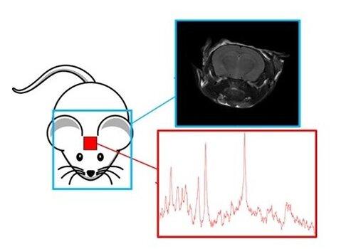 L’IRM (Imagerie par Résonance Magnétique) chez les insectes et les souris pour comprendre comment fonctionne notre cerveau La figure présente les deux technique issues de la RMN : l’IRM (Imagerie par résonance magnétique) et la SRM (spectroscopie par résonance magnétique). En haut : image de la tête de la souris. En bas : spectre de métabolites cérébraux obtenu dans une zone particulière du cerveau (le striatum).