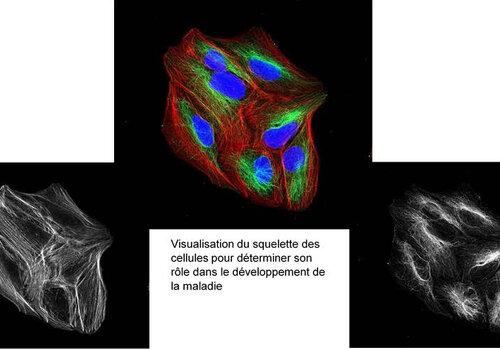 Une maladie génétique : comprendre pour guérir Visualisation du squelette des cellules pour déterminer son rôle dans le développement de la maladie.