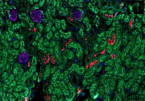 Visualisation des différentes structures du rein grâce à la fluorescence L'image permet de voir les structures du rein, identifiables par différentes couleurs fluorescentes.