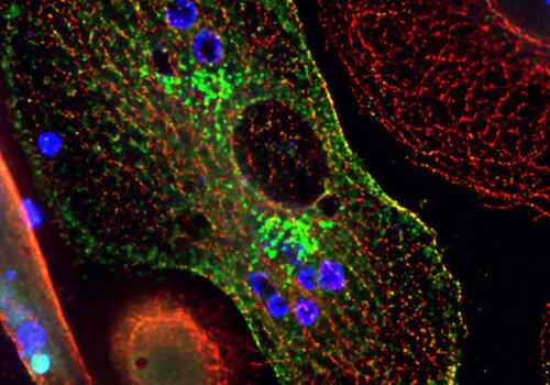 Cellule sentinelle au microscope à fluorescence