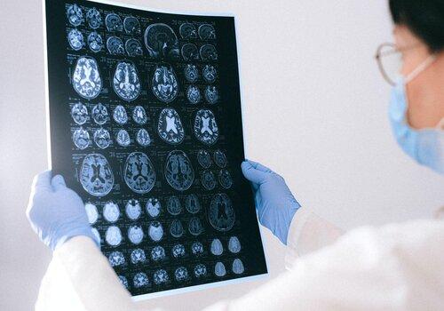 Alzheimer, un véritable casse tête... Anna Shvets / Pexels