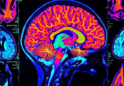 Imagerie et Cerveau