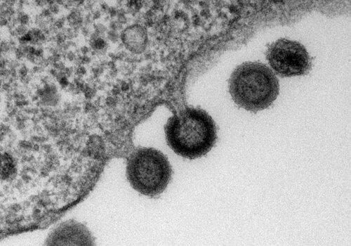 Virus du Sida sortant de la cellule (microscopie électronique)