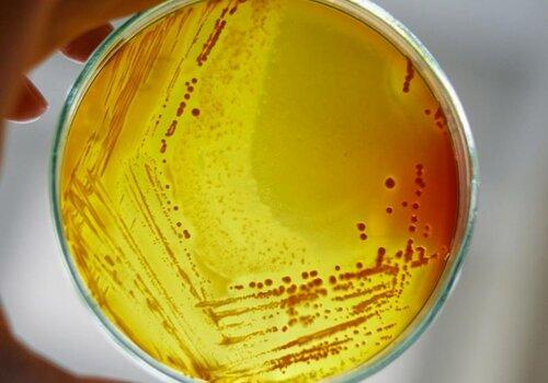 Isolement de bactéries sur une gélose en boite de Pétri