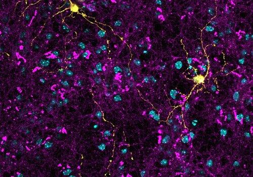 Neurone du cervelet en culture exprimant la GFP