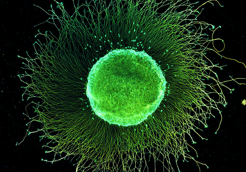 Explant de ganglion de racine dorsale. Réseau de microtubules en orange et réseau d’actine et de noyaux en cyan.