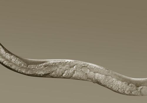 Image en microscopie optique d'un vers C. elegans