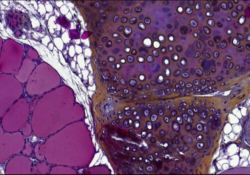 Lame d'histologie colorée et observée au microscope