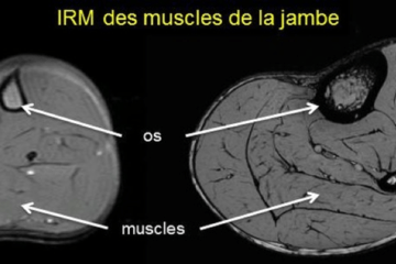 IRM des muscles de la jambe chez l'homme et chez le rat