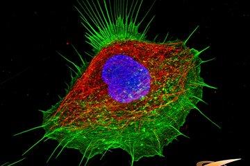 photo d'une cellules humaine montrant le cytosquelette (vert et rouge) et le noyau (bleu)