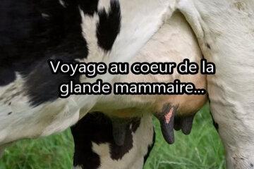 image Glande mammaire