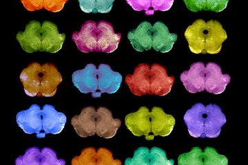 Le cerveau en couleur