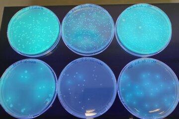 Bactéries en colonies (millions de bactéries/colonie) sur des boites de Petri, contenant un milieu gélosé nutritif