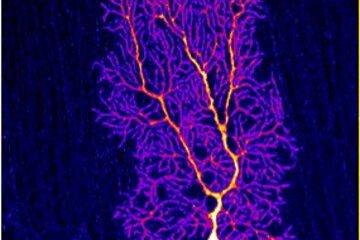 Neurone du cortex cérebelleux coloré