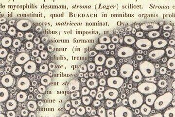 Stroma