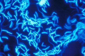  Spermatozoïdes de coq révélés par fluorescence supra-vitale (Hoechst 33342).