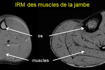 Visuel IRM