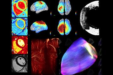 Ultrasons, IRM, EEG, MEG ... autant de technologies en pleine évolution