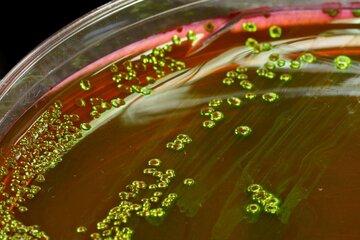 Gros plan de colonies de la bactérie Escherichia coli cultivée sur gélose EMB (Eosin Methylene Blue)