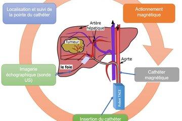 L'image représente le schéma de principe du projet Catheterbot