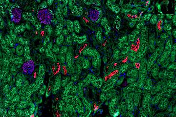L'image permet de voir les structures du rein, identifiables par différentes couleurs fluorescentes.