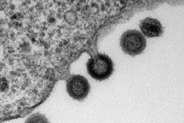Virus du Sida sortant de la cellule (microscopie électronique)