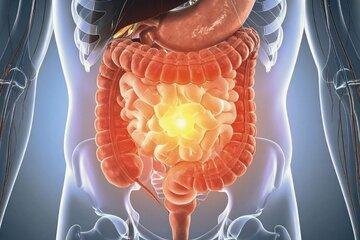 Les super-pouvoirs du microbiote