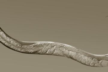 Image en microscopie optique d'un vers C. elegans