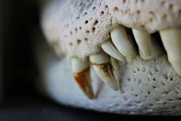 dents