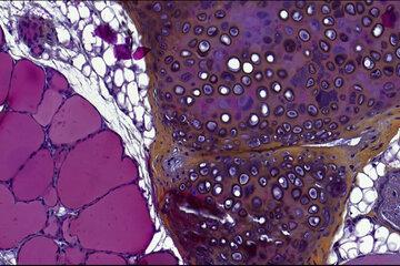 Lame d'histologie colorée et observée au microscope
